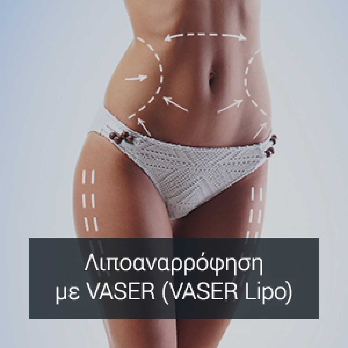 Λιποαναρρόφηση με VASER ( VASER Lipo )